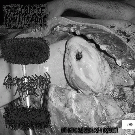 Gruesome Bodyparts Autopsy : The Infernal Gorenoise Torture